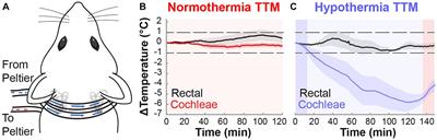 Targeted therapeutic hypothermia protects against noise induced hearing loss